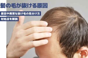 髪の毛が抜ける9つの原因｜異常な抜け毛の見分け方と対処法