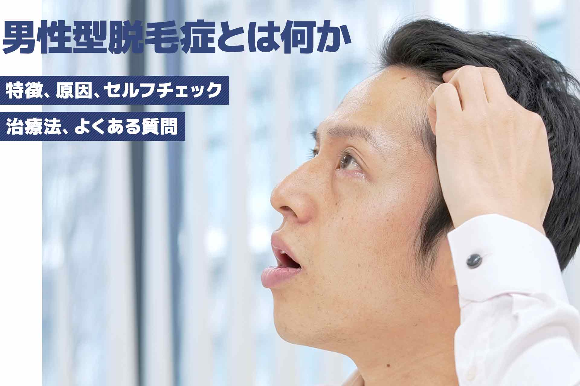 AGA（男性型脱毛症）とは？ 原因や治療薬、薄毛のセルフチェックの仕方を紹介